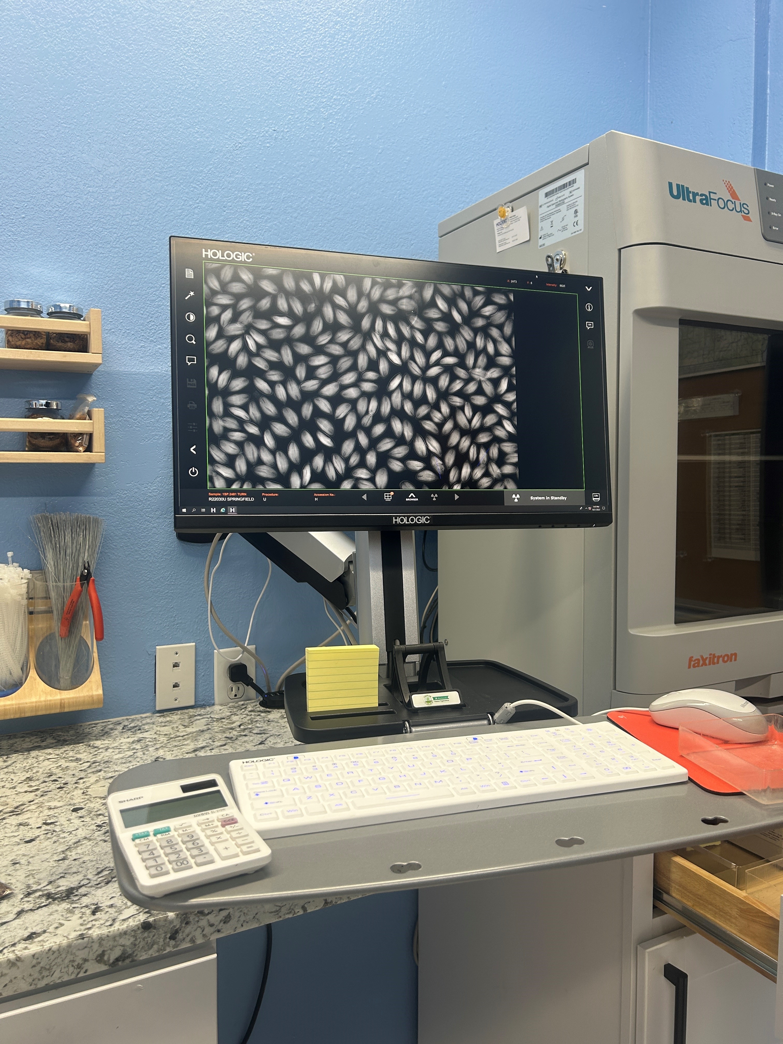 Image of an example of an X-ray of a seed sample.